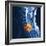 Slipped Disc, MRI Scan-PASIEKA-Framed Premium Photographic Print