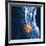 Slipped Disc, MRI Scan-PASIEKA-Framed Photographic Print