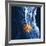 Slipped Disc, MRI Scan-PASIEKA-Framed Photographic Print