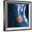 Slipped Disc, MRI Scan-PASIEKA-Framed Photographic Print