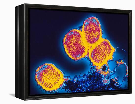 Smallpox Variola Viruses-PASIEKA-Framed Premier Image Canvas