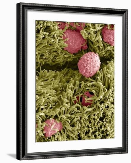 Snake Ciliated Lung Cells And Mucus, SEM-Steve Gschmeissner-Framed Photographic Print