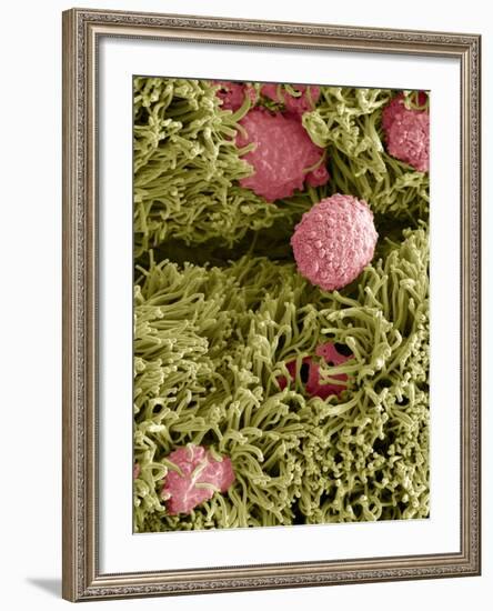 Snake Ciliated Lung Cells And Mucus, SEM-Steve Gschmeissner-Framed Photographic Print