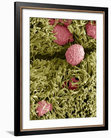 Snake Ciliated Lung Cells And Mucus, SEM-Steve Gschmeissner-Framed Photographic Print