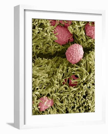 Snake Ciliated Lung Cells And Mucus, SEM-Steve Gschmeissner-Framed Photographic Print