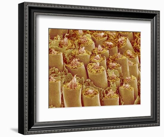 Sperm in Testis of a Rat-Micro Discovery-Framed Photographic Print