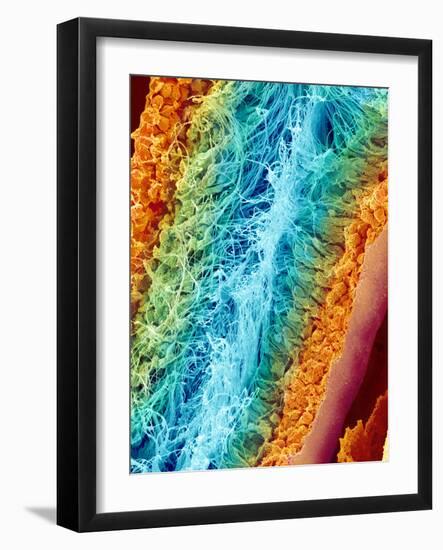 Sperm Production, SEM-Susumu Nishinaga-Framed Photographic Print