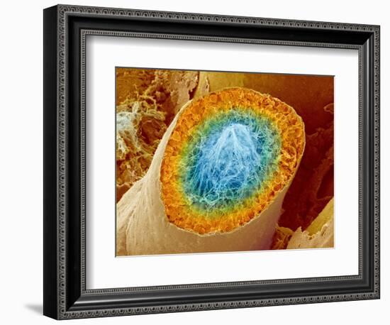 Sperm Production-Micro Discovery-Framed Photographic Print