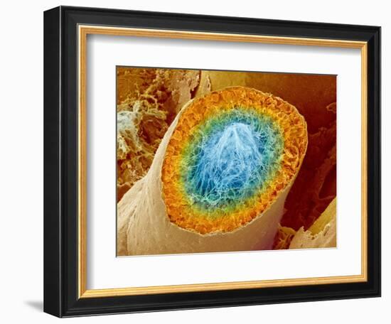 Sperm Production-Micro Discovery-Framed Photographic Print