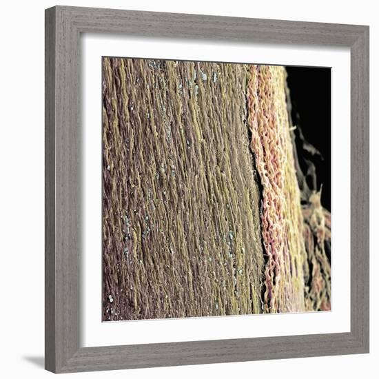Spinal Cord, SEM-Steve Gschmeissner-Framed Premium Photographic Print