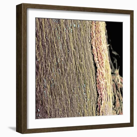 Spinal Cord, SEM-Steve Gschmeissner-Framed Premium Photographic Print