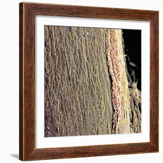 Spinal Cord, SEM-Steve Gschmeissner-Framed Premium Photographic Print