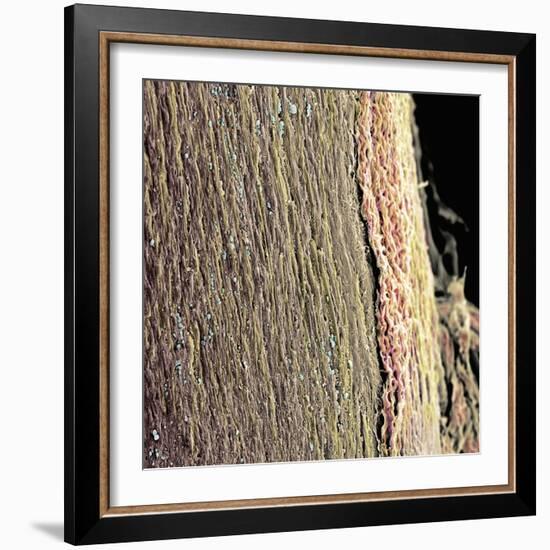 Spinal Cord, SEM-Steve Gschmeissner-Framed Premium Photographic Print