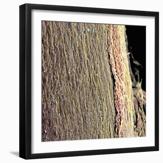 Spinal Cord, SEM-Steve Gschmeissner-Framed Premium Photographic Print