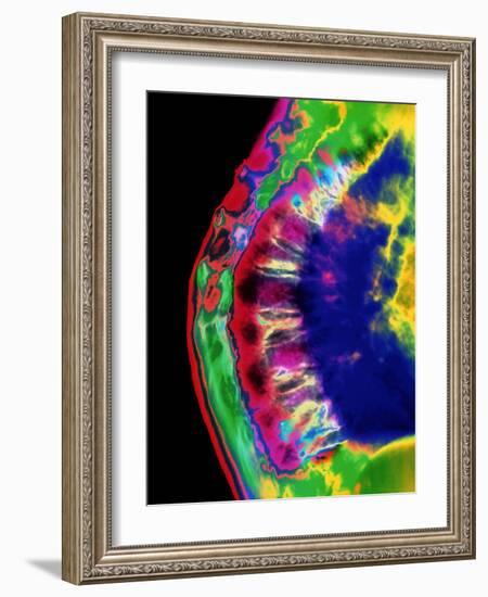 Spinal Osteoporosis-Mehau Kulyk-Framed Photographic Print