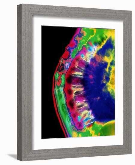 Spinal Osteoporosis-Mehau Kulyk-Framed Photographic Print