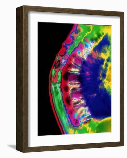 Spinal Osteoporosis-Mehau Kulyk-Framed Photographic Print