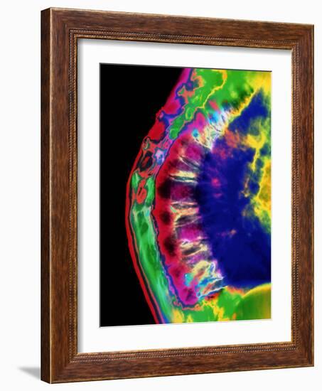 Spinal Osteoporosis-Mehau Kulyk-Framed Photographic Print