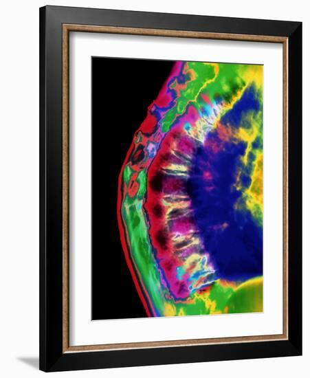 Spinal Osteoporosis-Mehau Kulyk-Framed Photographic Print