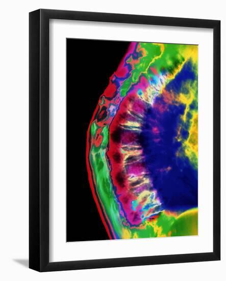 Spinal Osteoporosis-Mehau Kulyk-Framed Photographic Print