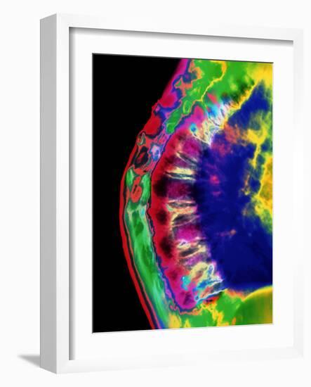 Spinal Osteoporosis-Mehau Kulyk-Framed Photographic Print