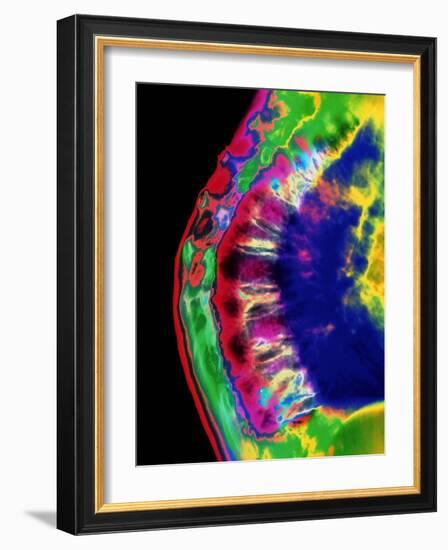 Spinal Osteoporosis-Mehau Kulyk-Framed Photographic Print