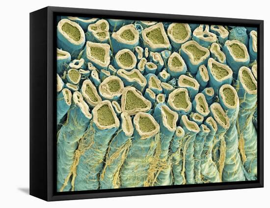 Spinal Root Nerves, SEM-Thomas Deerinck-Framed Premier Image Canvas