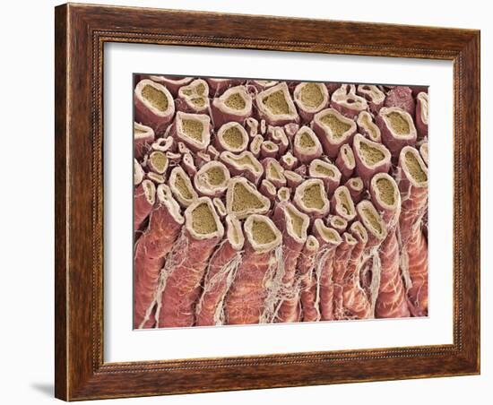 Spinal Root Nerves, SEM-Thomas Deerinck-Framed Photographic Print