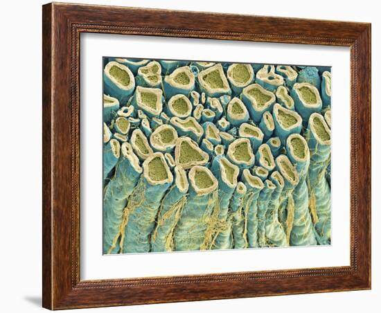 Spinal Root Nerves, SEM-Thomas Deerinck-Framed Photographic Print