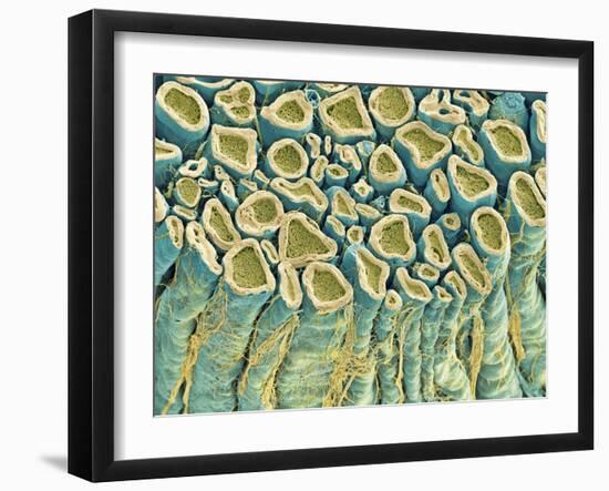 Spinal Root Nerves, SEM-Thomas Deerinck-Framed Photographic Print