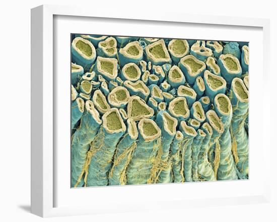 Spinal Root Nerves, SEM-Thomas Deerinck-Framed Photographic Print