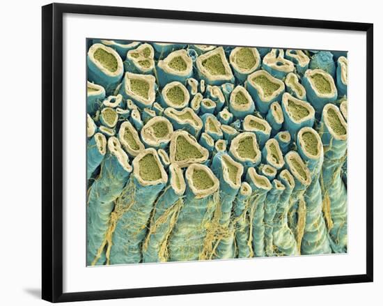 Spinal Root Nerves, SEM-Thomas Deerinck-Framed Photographic Print