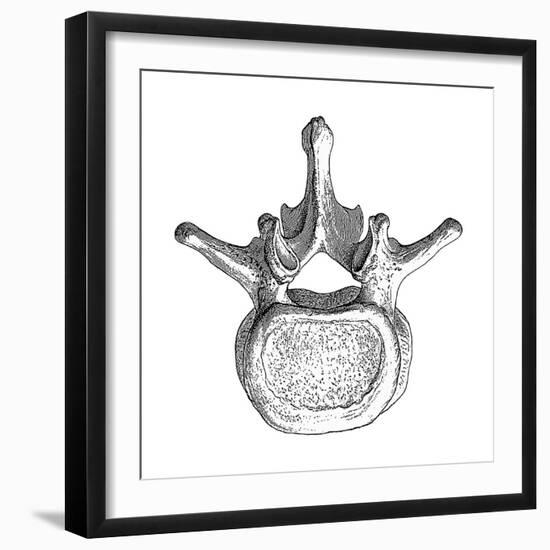 Spinal Vertebra-Mehau Kulyk-Framed Photographic Print