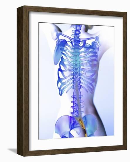 Spine, Computer Artwork-Christian Darkin-Framed Photographic Print