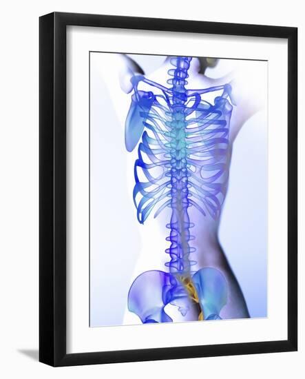 Spine, Computer Artwork-Christian Darkin-Framed Photographic Print