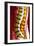 Spine Degeneration, MRI Scan-Du Cane Medical-Framed Photographic Print