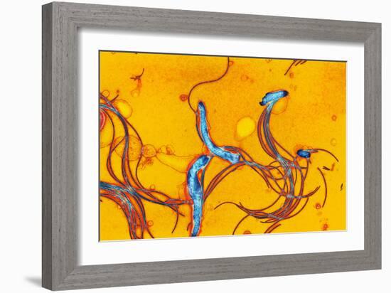 Spirochete Bacteria, TEM-Hazel Appleton-Framed Photographic Print