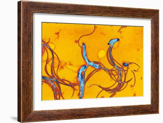 Spirochete Bacteria, TEM-Hazel Appleton-Framed Photographic Print