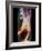 Sprained Ankle, X-ray-ZEPHYR-Framed Photographic Print