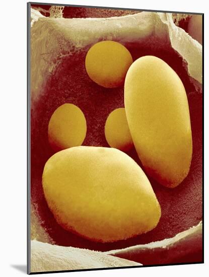 Starch Grains of Potato Cells-Micro Discovery-Mounted Photographic Print