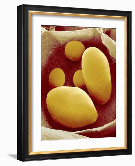 Starch Grains of Potato Cells-Micro Discovery-Framed Photographic Print