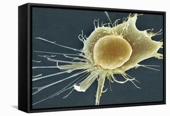 Stem Cell, SEM-Science Photo Library-Framed Premier Image Canvas