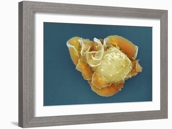 Stem Cell, SEM-Science Photo Library-Framed Photographic Print
