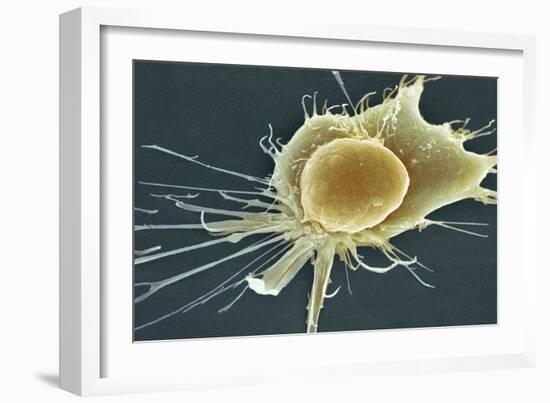 Stem Cell, SEM-Science Photo Library-Framed Photographic Print