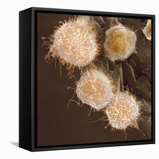 Stem Cells, SEM-Science Photo Library-Framed Premier Image Canvas