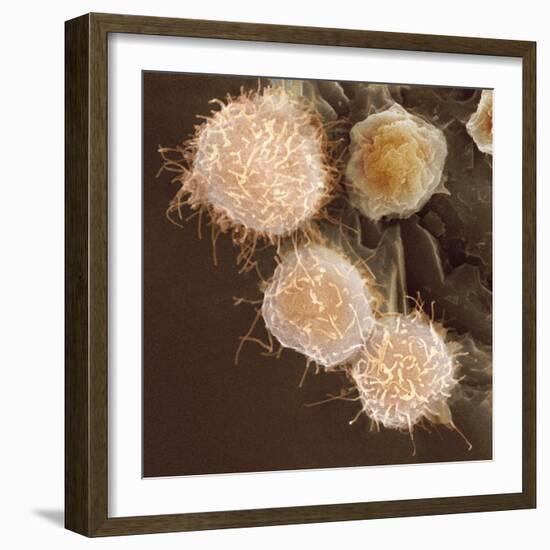 Stem Cells, SEM-Science Photo Library-Framed Premium Photographic Print