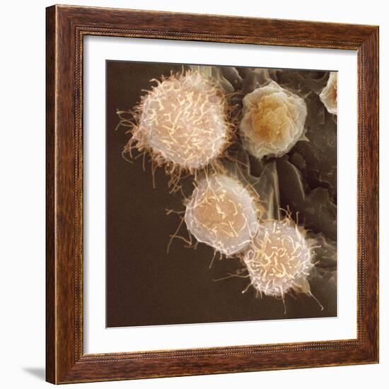 Stem Cells, SEM-Science Photo Library-Framed Premium Photographic Print