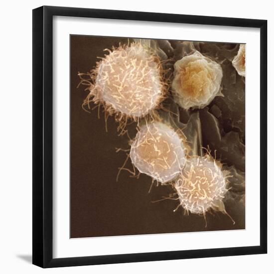 Stem Cells, SEM-Science Photo Library-Framed Premium Photographic Print