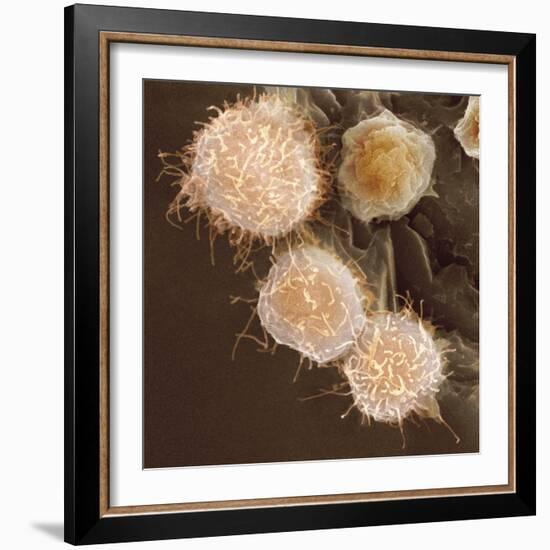 Stem Cells, SEM-Science Photo Library-Framed Premium Photographic Print