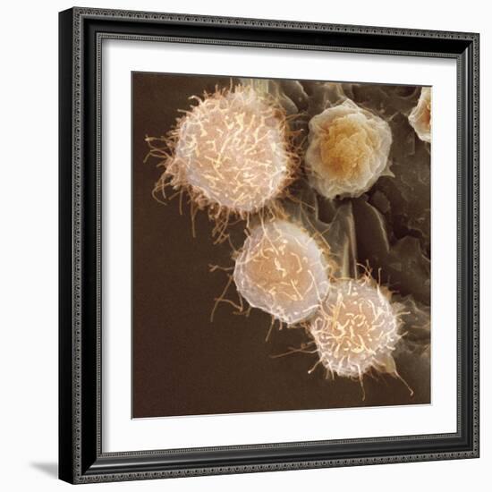 Stem Cells, SEM-Science Photo Library-Framed Premium Photographic Print